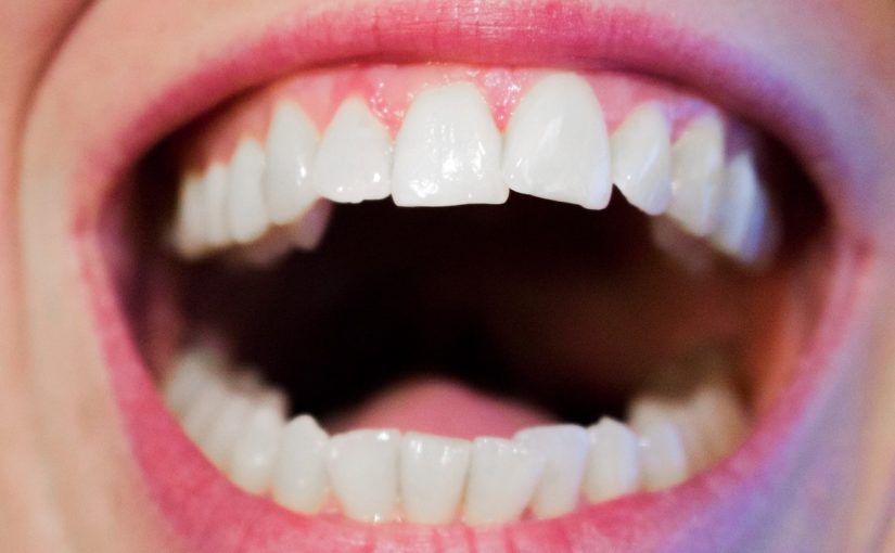 Aktualna technika stosowana w salonach stomatologii estetycznej zdoła spowodować, że odzyskamy śliczny uśmiech.